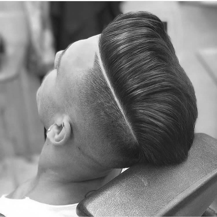 Undercut with long surgical line